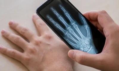 Como Usar Seu Celular Android como Raio X Portátil