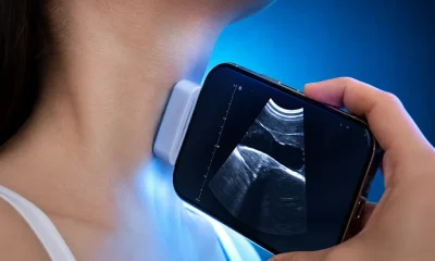Ultrassom pelo Celular: App de Diagnóstico